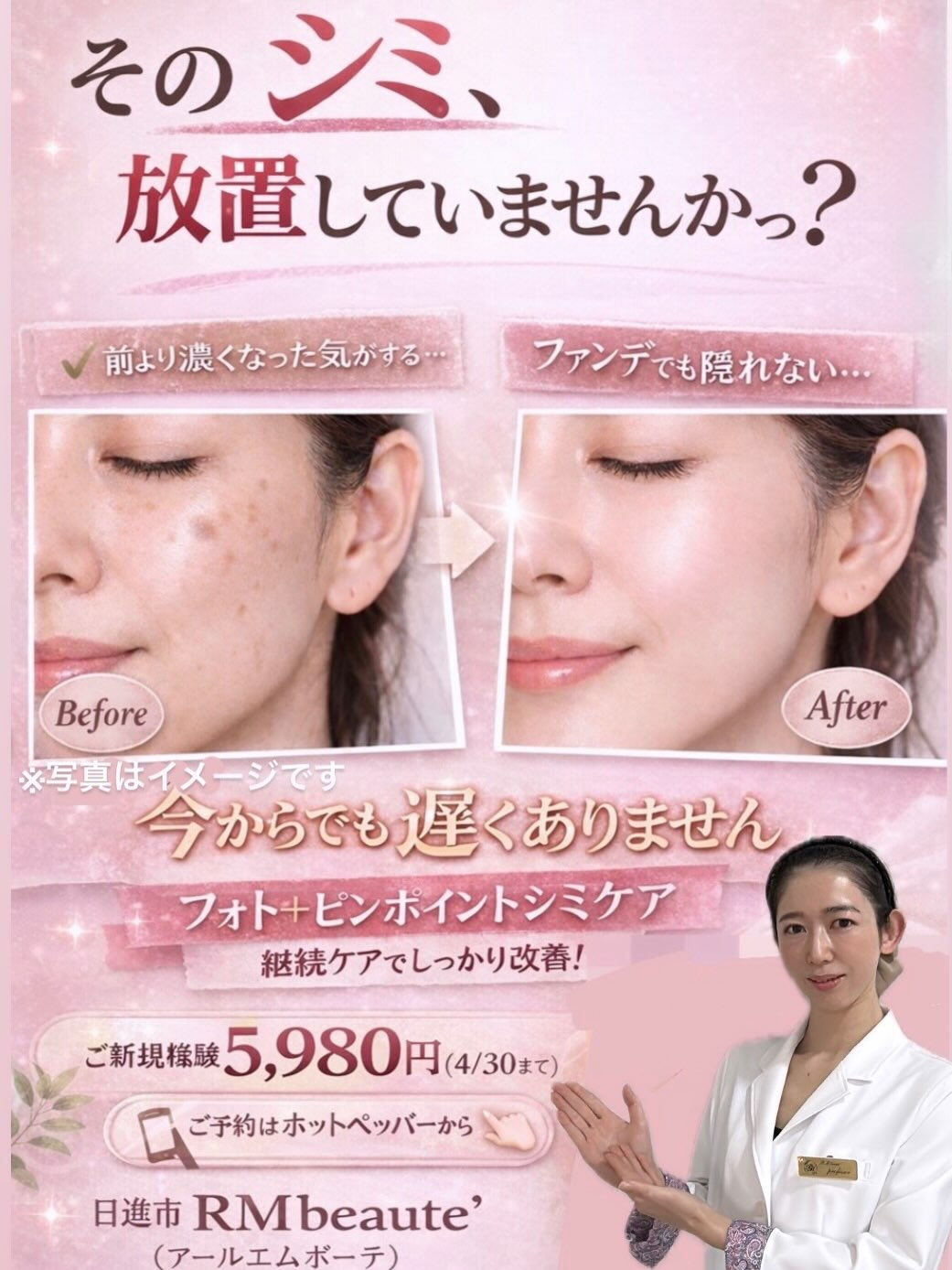 【5回でここまで変化✨フォト＋シミケア】